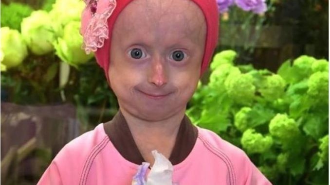 На само 13 години почина од старост: Тешката и жална судбина на Ирина Хамиќ од Украина