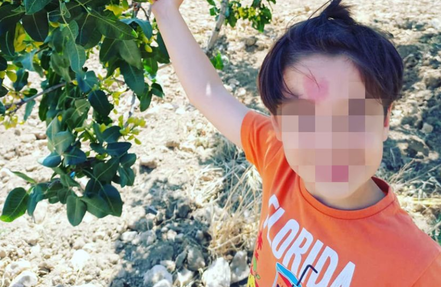 Има лузна во облик на срце на челото и го нарекуваат „бебето на љубовта“: „Чинар е роден за да ги зближи луѓето“