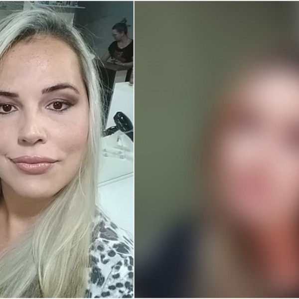 Осакатена и деформирана сум, си го сакам лицето назад: Маријана покажа фотки пред и после естетските корекции - последиците се страшни