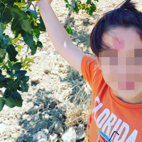 Има лузна во облик на срце на челото и го нарекуваат „бебето на љубовта“: „Чинар е роден за да ги зближи луѓето“